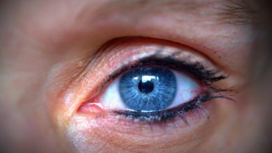 Photo of The Bruise Under the Eye – Causes, Treatment & Prevention